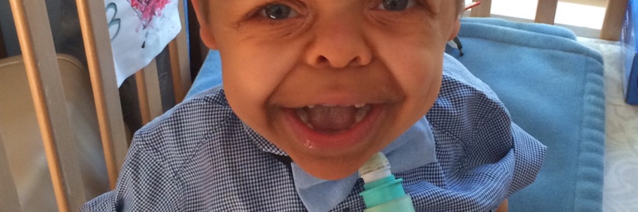 Posting Photos of My Son With Thanatophoric Dysplasia boy with dwarfism smiling in his crib