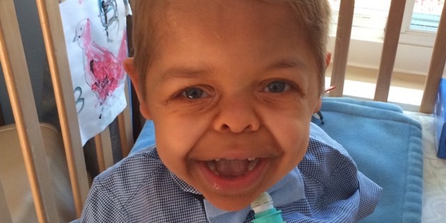 boy with dwarfism smiling in his crib