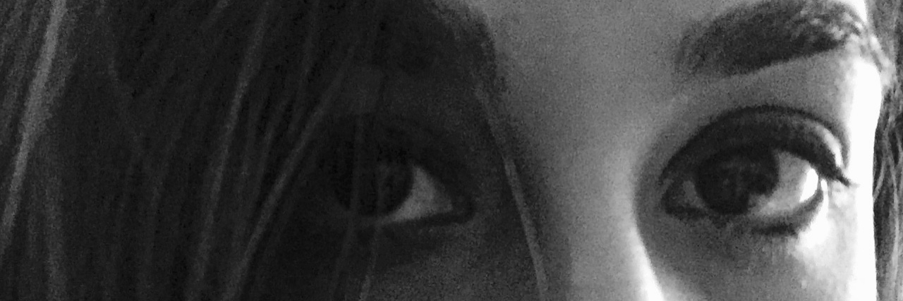 Feeling 'Weird' Symptoms of POTS and Lyme Disease black and white photo of eyes