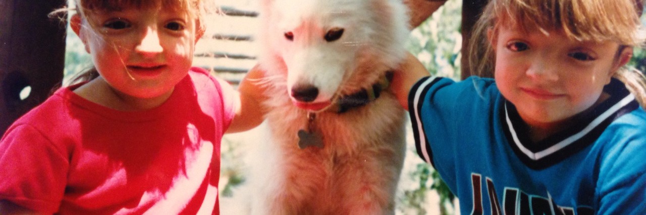 The Challenges of Growing Up With Crouzon Syndrome Ariel and her sister with their dog