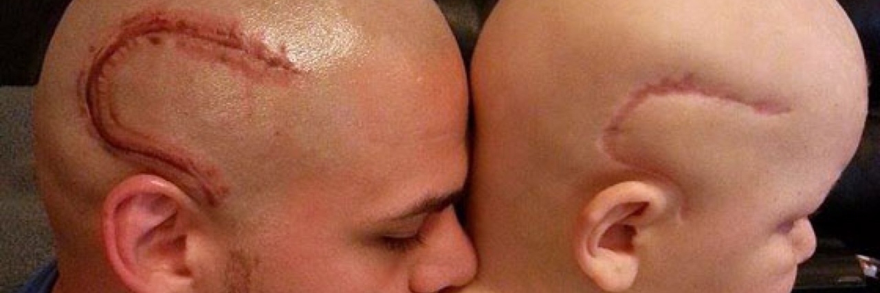 Man Wins #BestBaldDad Contest With a Tattoo of His Son's Cancer Scar Josh and Gabriel Marshall