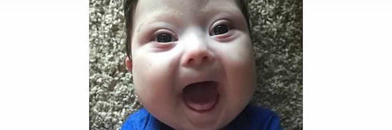 Feeling Like My Life Was Over After My Baby's Down Syndrome Diagnosis kaleb smiling