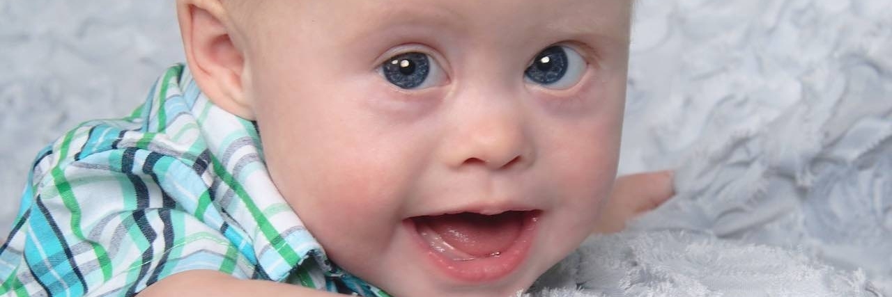 Mom Responds to False Positive on Prenatal Down Syndrome Diagnosis author's baby, who has down syndrome