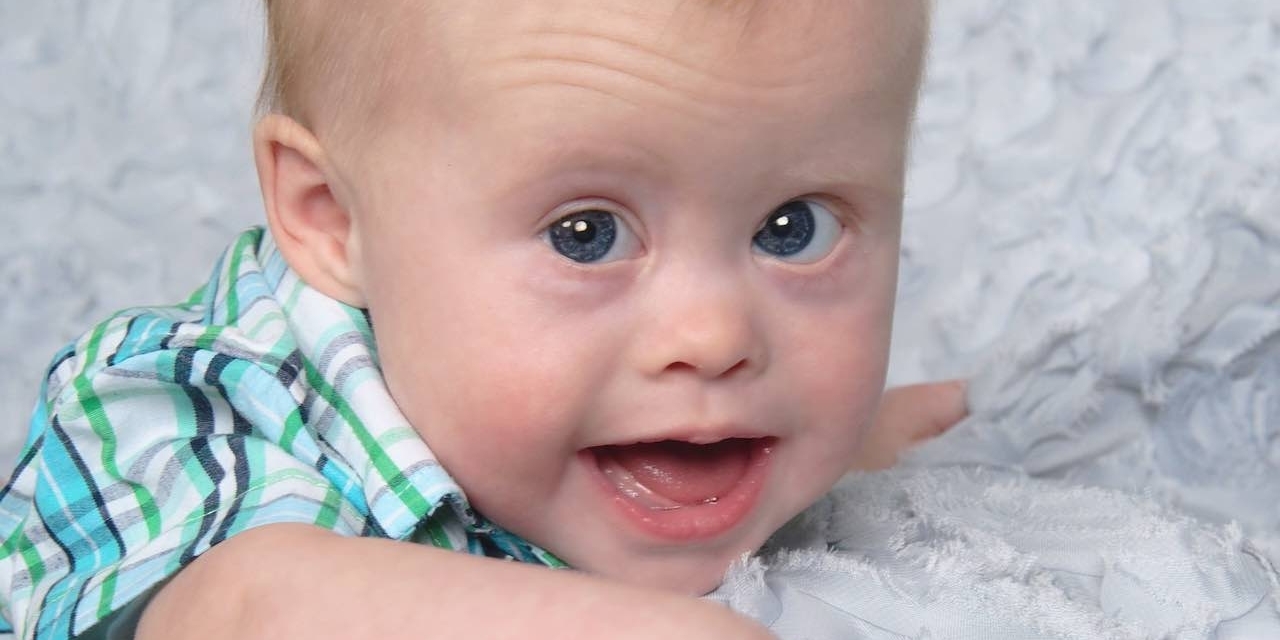 Mom Responds To False Positive On Prenatal Down Syndrome Diagnosis