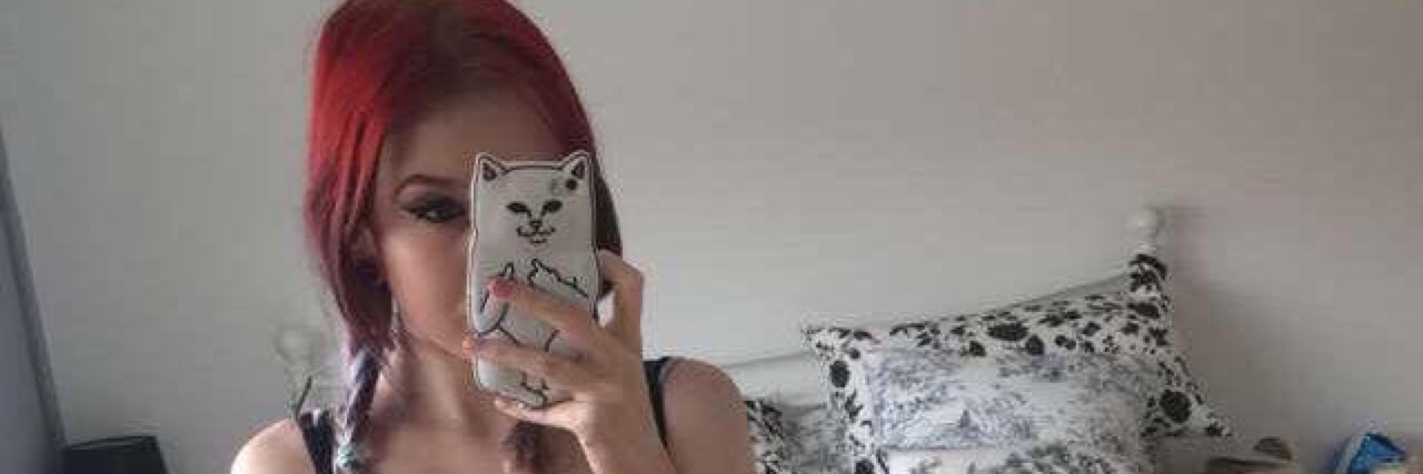 Aimee Rouski Shares Photos of Ileostomy Bag to Raise Crohn's Awareness