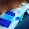 arm on chair with iv for infusion