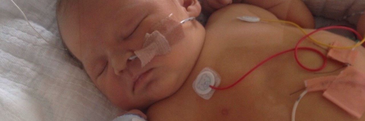 What to Know When Your Child Is in the NICU