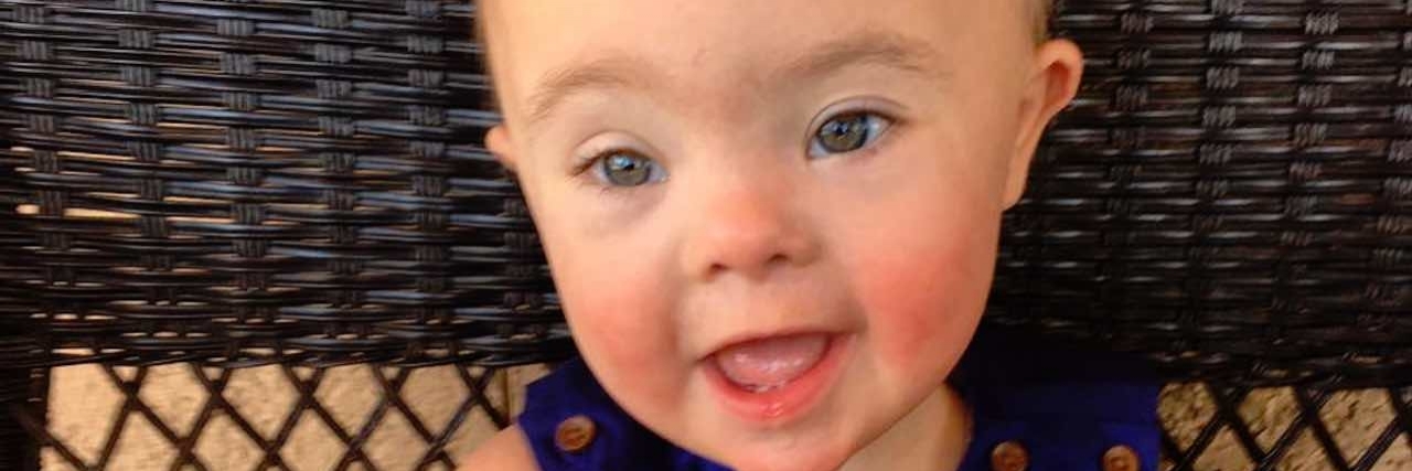 Rebuttal to an OB-GYN's Time Article on Down Syndrome Diagnosis Ethics author's baby, anderson