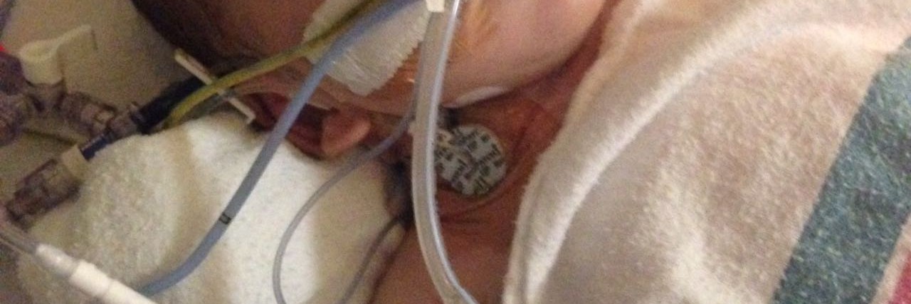 A Mom's Apology/Thank You Letter to Her Son's NICU Nurses