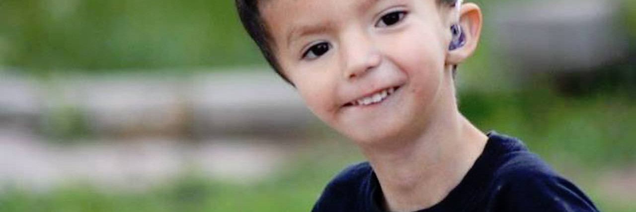 Adopting Special Needs Children and Teaching Them About Differences