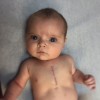 baby with heart surgery scar