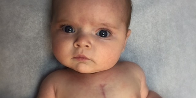 To the Spouse of My Daughter's Heart Surgeon baby with heart surgery scar