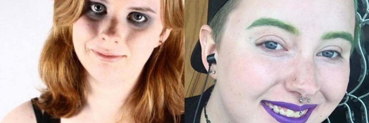 Self-Harm Recovery: A Letter to My Teenage Self split image of the offer then and now