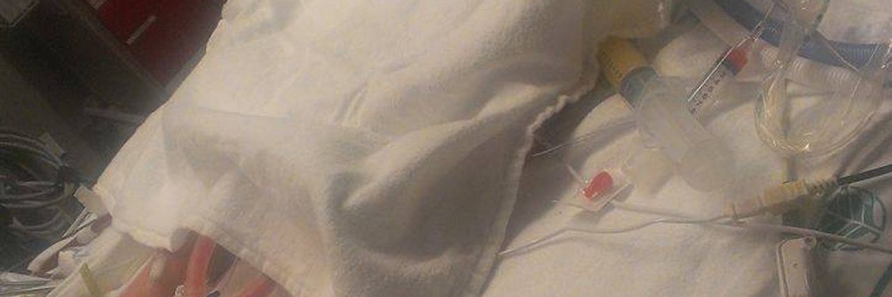 Having a Child With a Cor Triatriatum Heart Defect Ariel May in the ICU