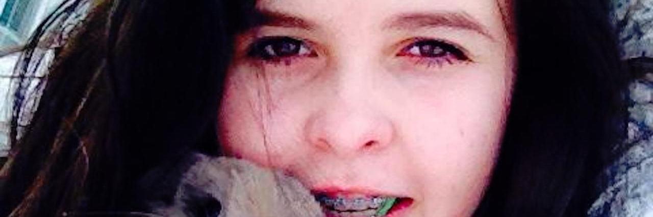 Young Woman Explains Life on the Autism Spectrum alex with a bunny