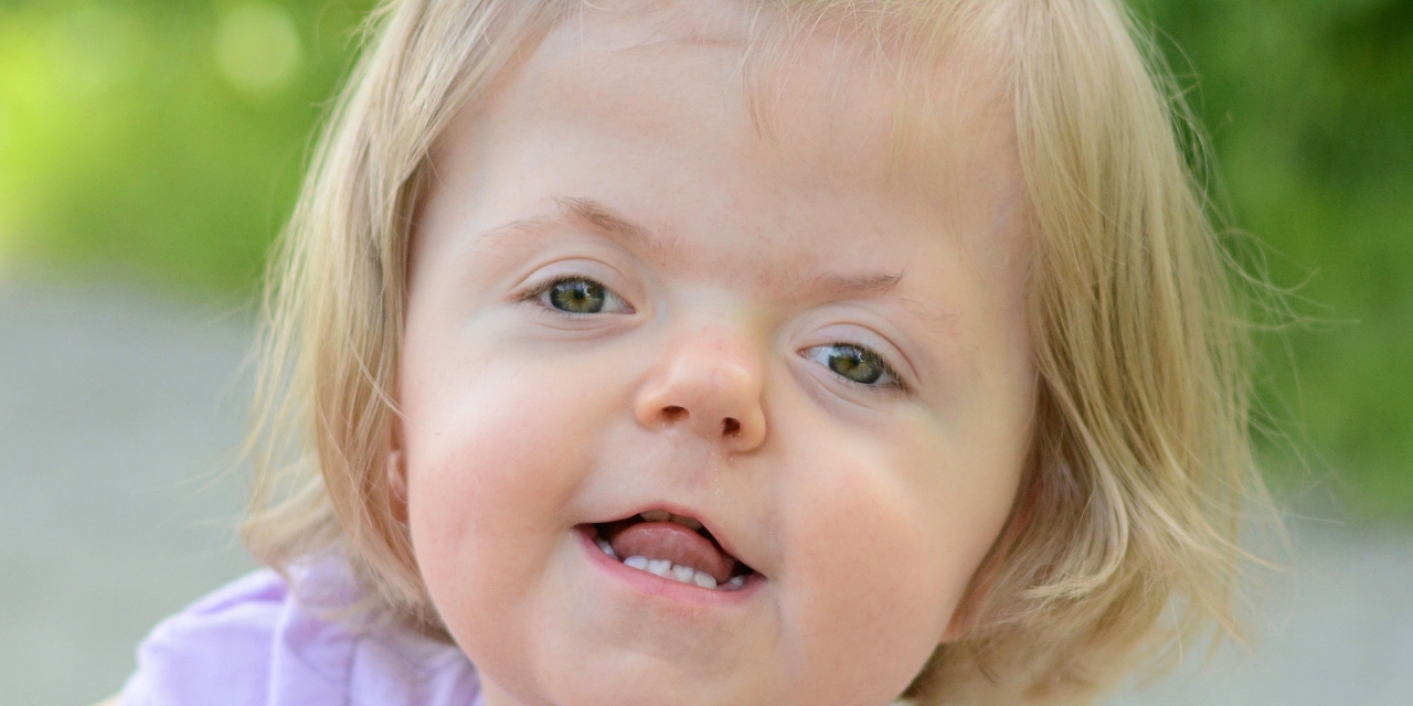 The Difficult Questions When Parenting a Child With Apert Syndrome ...