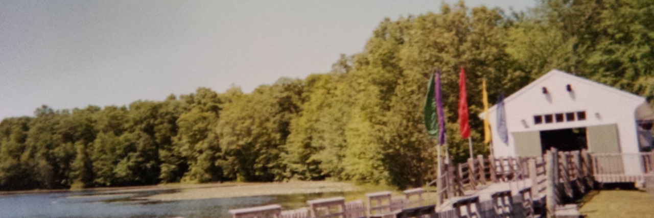 Attending Paul Newman's Hole in the Wall Gang Camp Anna at camp looking over the water