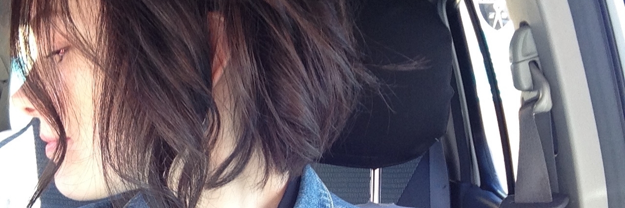 Trichotillomania: Pulling at the Roots of My Shame