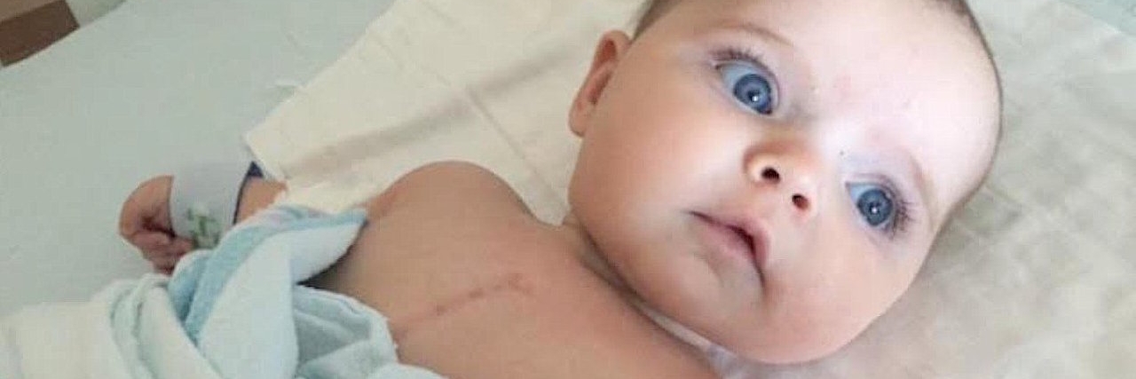 Congenital Heart Defects: What Parents Want You to Know Christina Schuetz's child