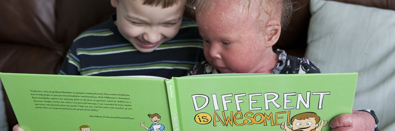 Teaching My Daughter With a Disability to Accept Others' Differences Two children, one with icthyosis, reading a book titled 'Different is Awesome.'
