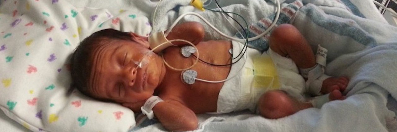 What I Learned During My Babies’ Time in the NICU