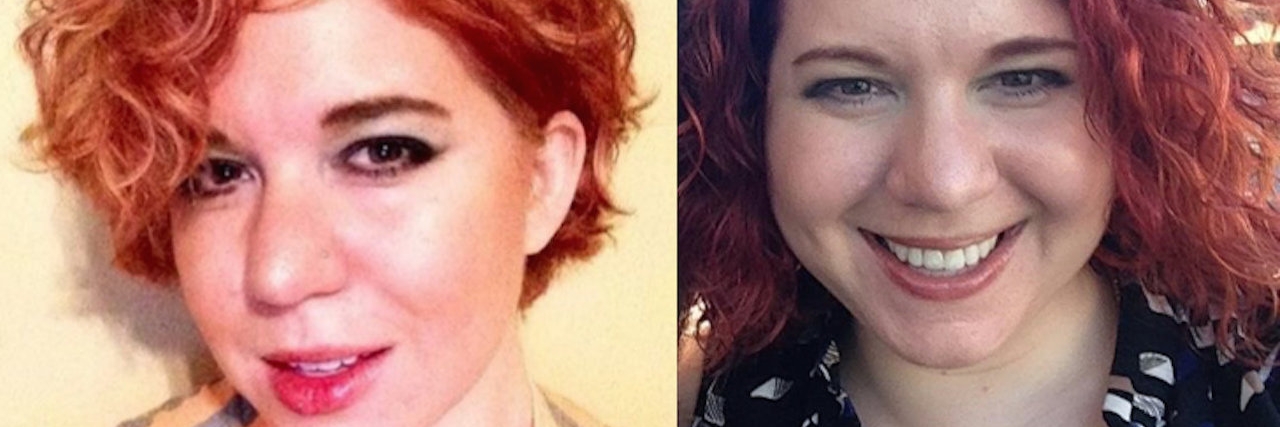 Chronic Illness Treatments: Coping With Physical Changes Sami Jankins