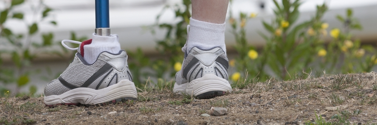 Empowerment Through Educating Kids About Amniotic Band Syndrome Prosthetic leg.