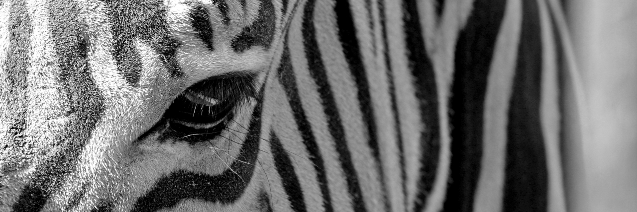 What It Means to Be a Medical Zebra With Ehlers-Danlos Syndrome