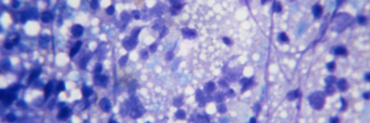 Microscopic Image of Bone Marrow Cells Dividing