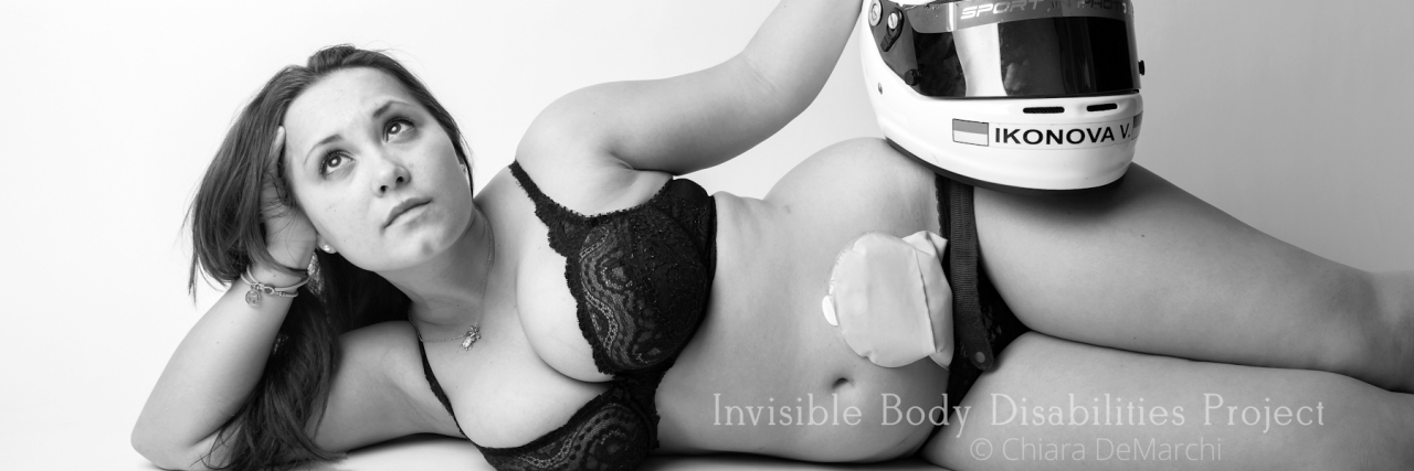 Chiara DeMarchi's Invisible Body Disabilities Project of IBD Photos Valentyna lives with Crohn's disease