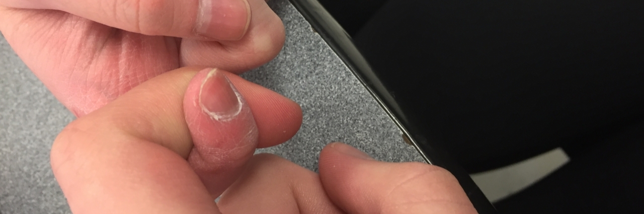 How My Friend From Best Buddies Supports My Chronic Illness two girls linking fingers