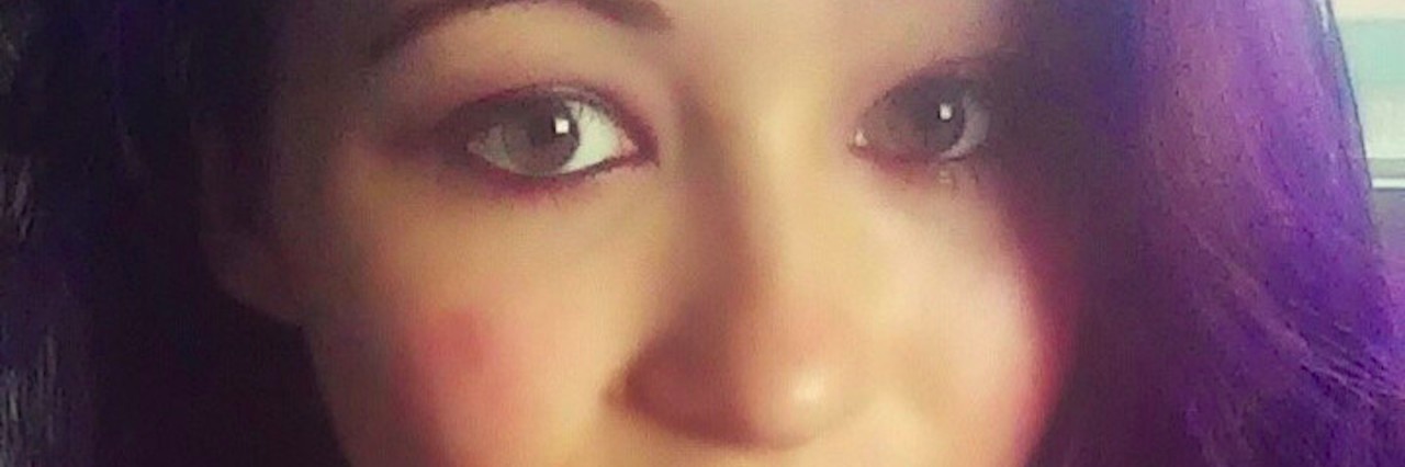 What to Know About Someone Living With Epilepsy The author, with purple hair