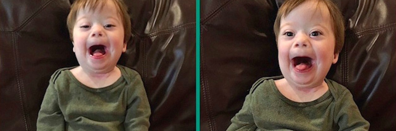 Down Syndrome: What My 2-Year-Old Son Has Taught Me Amanda McCollum’s son, Miles