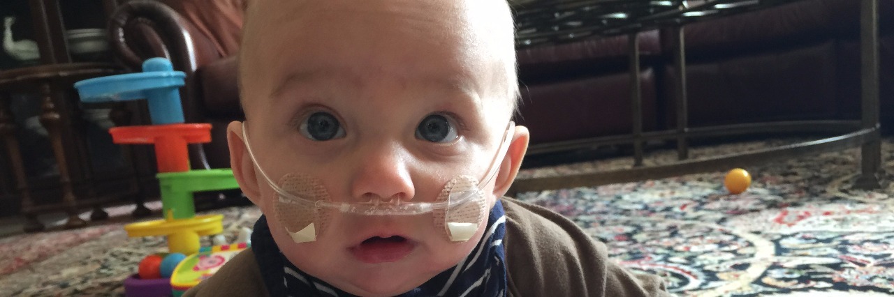 Pierre-Robin Sequence Diagnosis: Advice for a Scared New Mom baby crawling