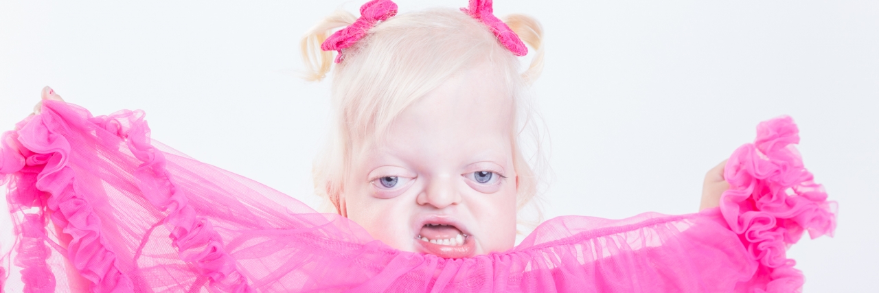 Changing the Face of Beauty Headshot Clinic for Kids With Disabilities Little girl with facial difference modeling