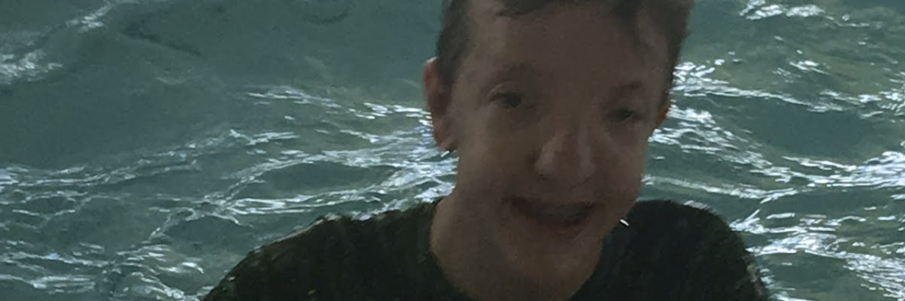 When My Son With Apert Syndrome Said People Were Staring at Him Lisa Brown's son in the pool.