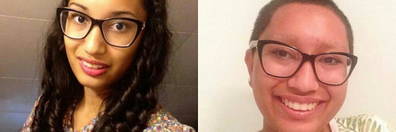 To My Younger Self Trying to Hide the Effects of Trichotillomania A side-by-side photo of the author at 14 and today at 17