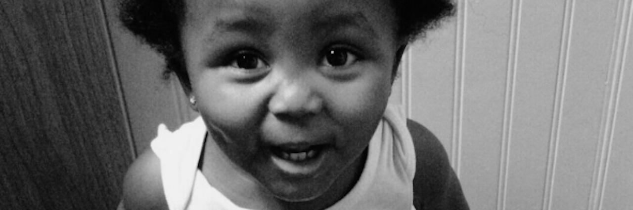 Parenting a Child With Congenital Generalized Lipodystrophy Alani smiling