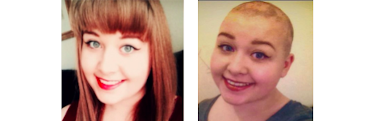before and after of woman who shaved her head