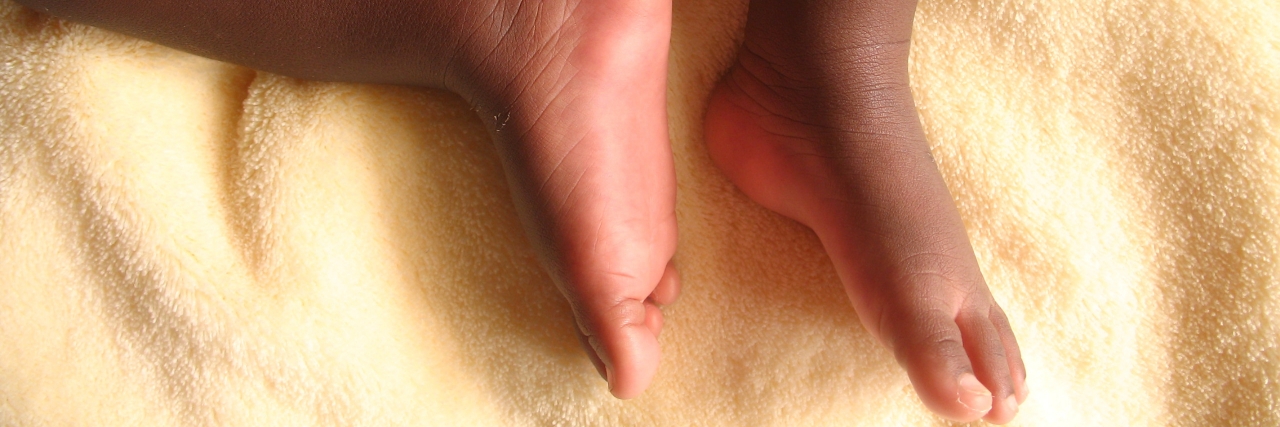 Bipolar Disorder and Parenting: I'm Not Afraid to Have Kids baby feet