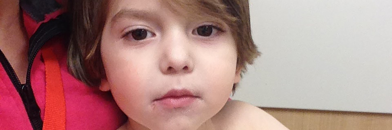 When People Say 'What Do You Mean, He Can't Eat?' Cohen's feeding tubes.