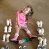 Little girl with bilateral clubfeet surrounded by her old braces and casts.