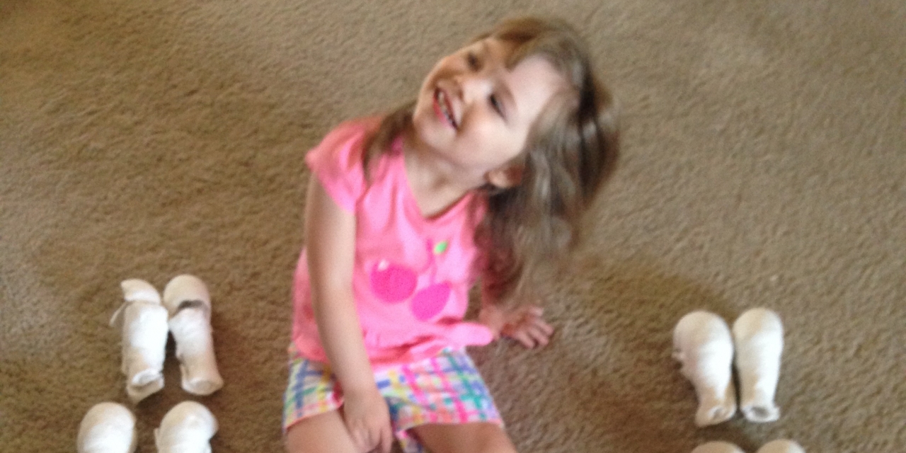 Having a Child With Bilateral Club Feet The Mighty