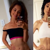 before and after surgery selfies of sylvia