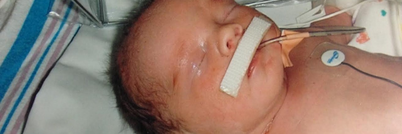 When a Nurse Said to Me, ‘If Your Child Lives…’