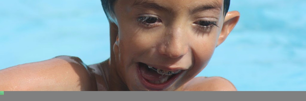 Mom Responds to Staring/Comments About Her Son With Goldenhar Syndrome little boy in the pool