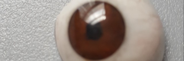 prosthetic eye