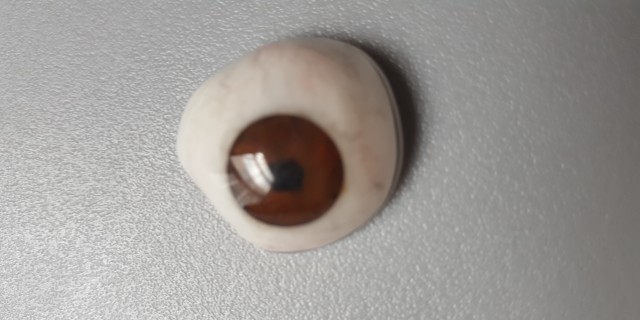 prosthetic eye