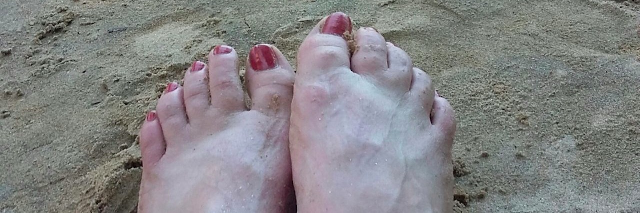 Chronic Illness: I’m Going to Tell You How I Really Feel woman puts feet up by the river