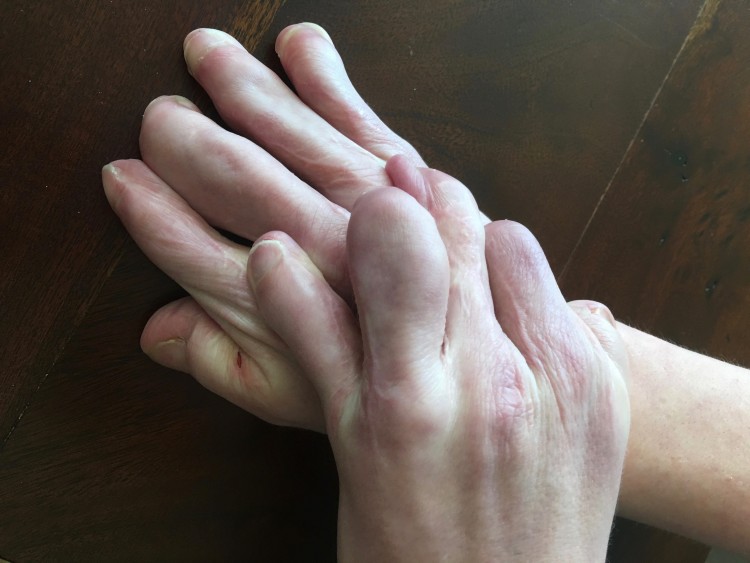 LIsa's sons hands.